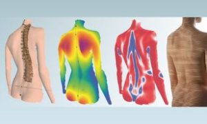 3D-Wirbelsäulenvermessung & Haltungsanalyse in meiner Praxis in Affoltern am Albis